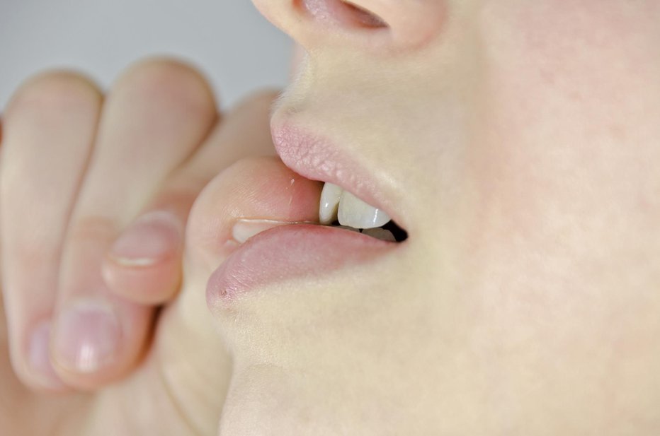 Fotografija: Takšno početje ne prizanaša niti zobem. FOTO: Precinbe/Getty Images